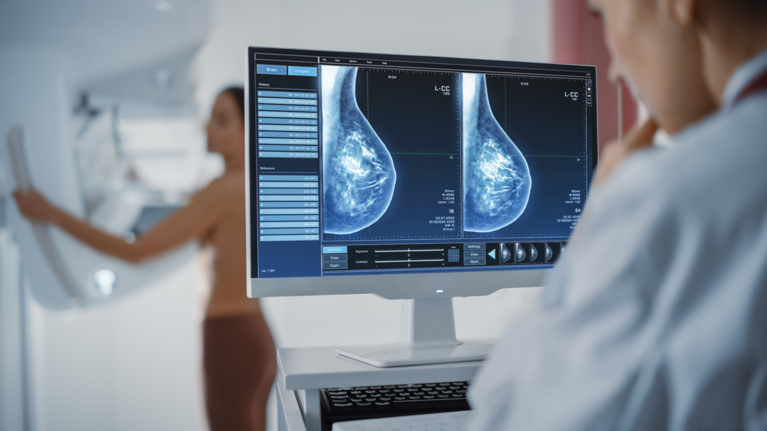Breast Tomosynthesis